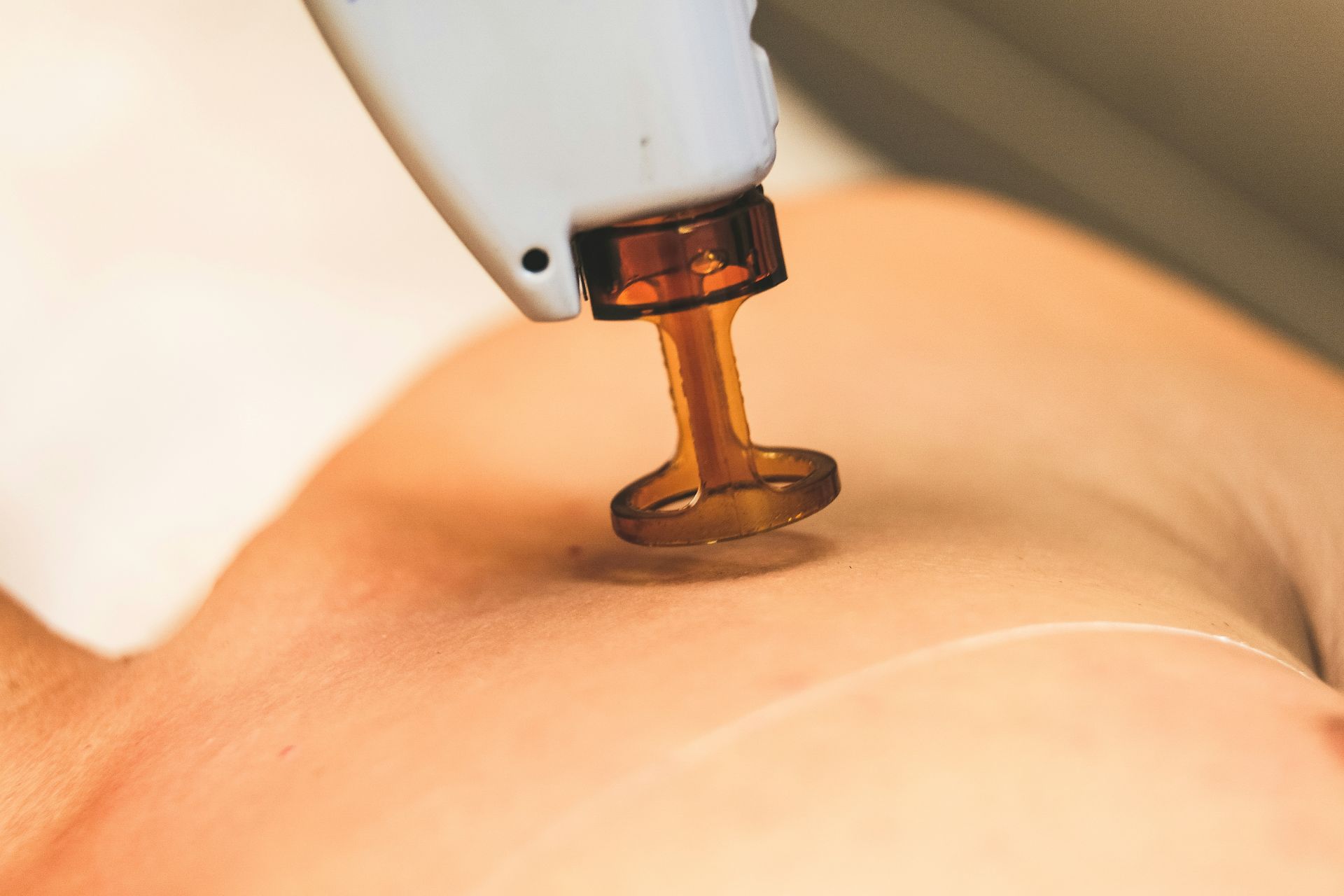 Trattamenti estetico del corpo