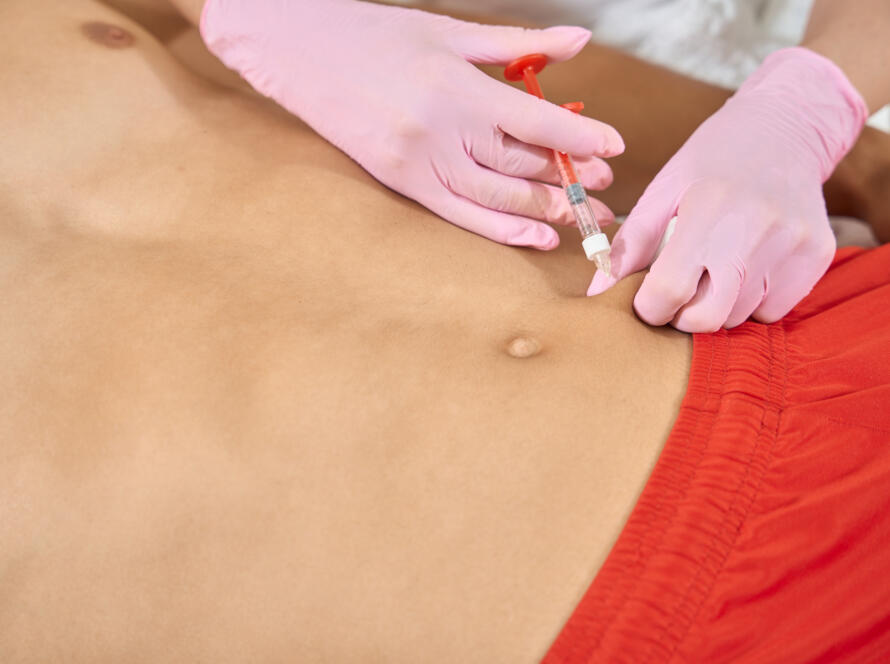 Intralipoterapia
