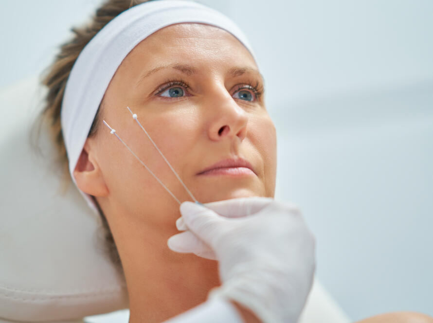 Fili di biostimolazione