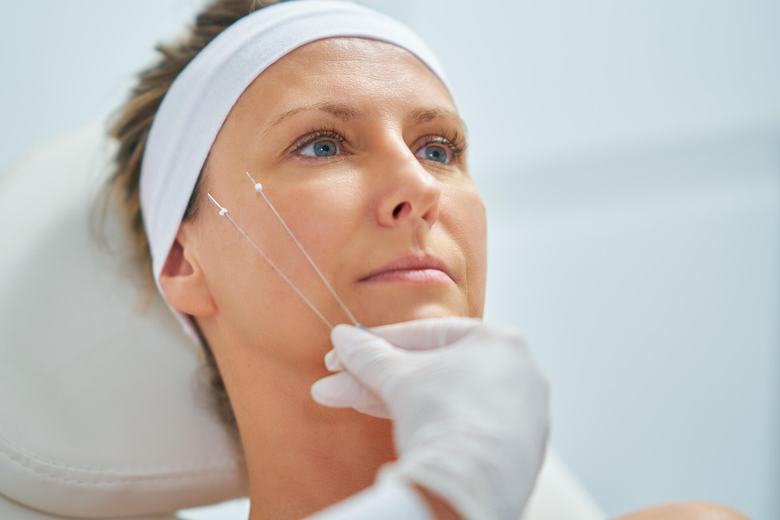 Fili di biostimolazione